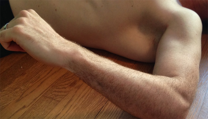 Photo #1: Hand stops before normal range